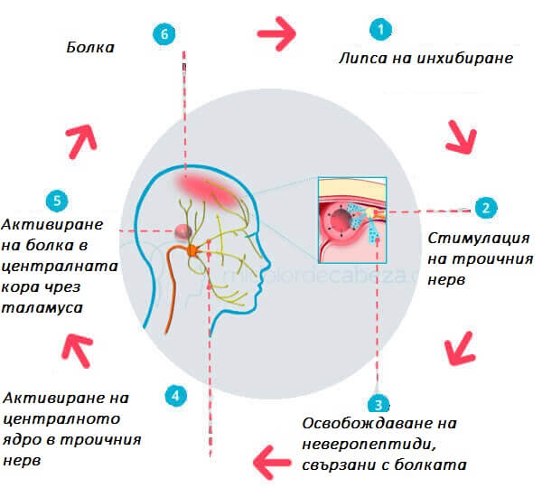 симптоми на мигрената - една от най-честите болести при жените