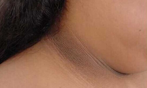 4 начина да заличите тъмната кожа по шията си