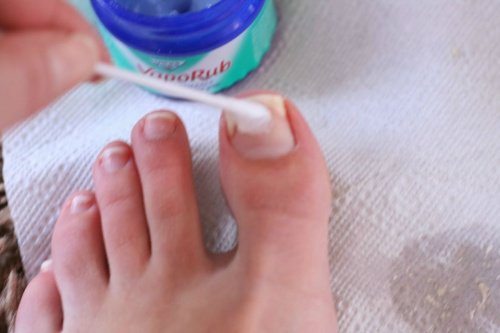 Vaporub при гъбички по ноктите