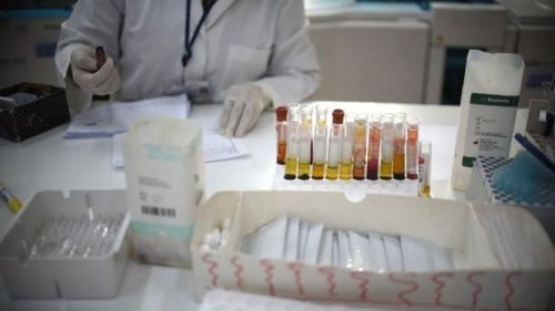 медицинските власти са се подготвили за Кримска-Конго хеморагичната треска