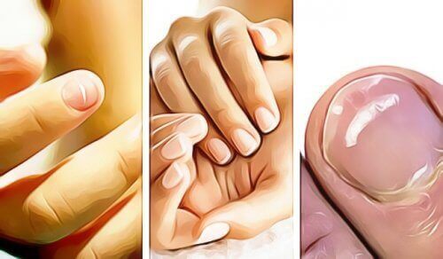 5 знака, с които ноктите ви показват, че нещо не е наред със здравето ви