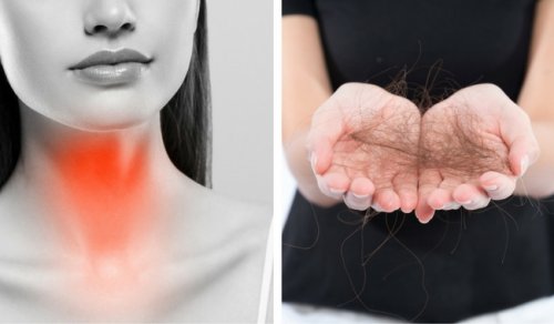 8 съвета за борба с косопада, свързан с щитовидната жлеза