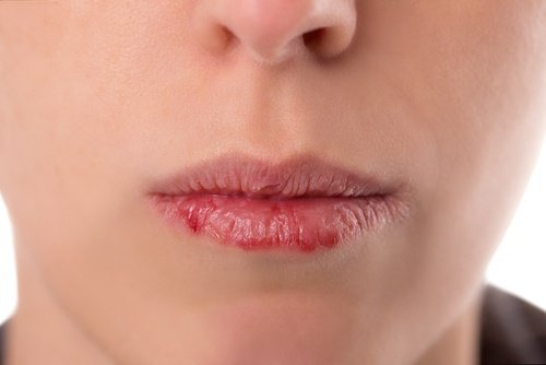 Важно! Рак на гърлото - симптоми и превенция