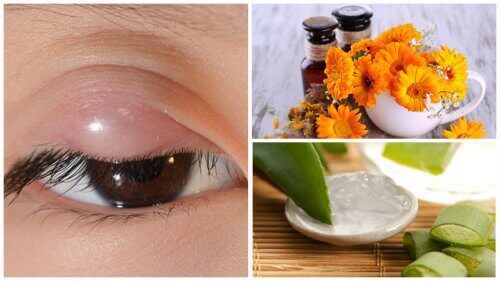 Излекувайте ечемика на окото с тези 7 натурални средства