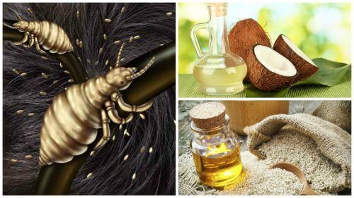 Преборете въшките с тези 5 домашни средства