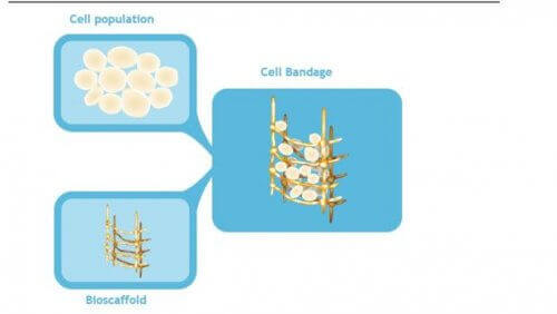 превръзка със стволови клетки за коляното