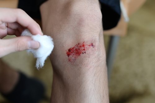 Бавното зарастване на раните е сред признаците на високата кръвна захар.