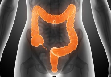 Газовете може да са причинени от синдрома на раздразненото дебело черво.