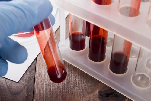 Ракът вече може да бъде открит рано с кръвни тестове