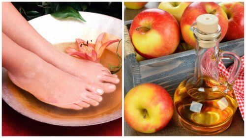 6 предимства от накисването на краката ви в оцет