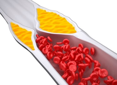 4 смутита, които контролират нивата на холестерол