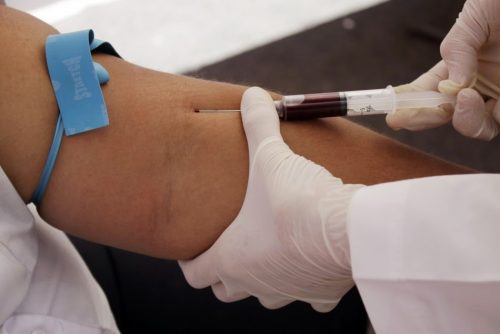 Меотода с провеждане на кръвен тест улеснява намирането на атакуваните тъкани.