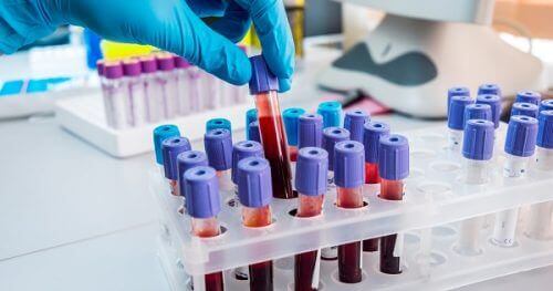 кръвен тест позволява да се установи наличие на злокачествени клетки