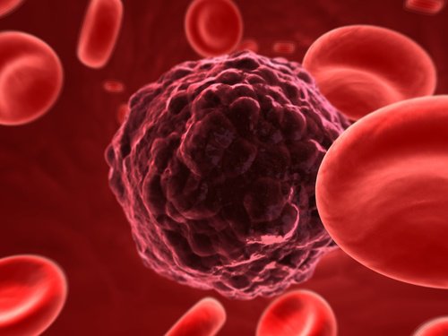 с кръвен тест Калифорнийския университет Калифорнийския университет установява генетични маркери на рака.