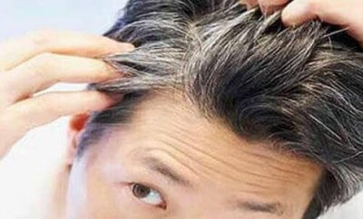 Предотвратете ранното побеляване на косата с тези 6 храни и витамини