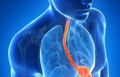 10 странни симптоми на киселинен рефлукс