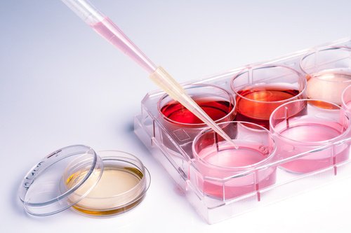 лабораторни изследвания в борбата срещу рака на яйчниците и панкреаса