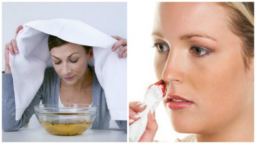 7 ефикасни домашни средства при кървене от носа