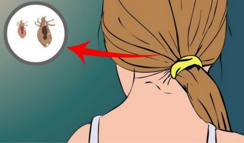 Как да се отървете от въшките по косата естествено