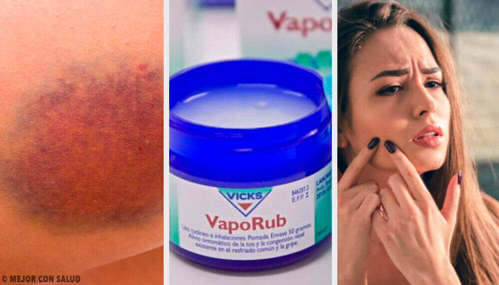 11 изненадващи приложения на мехлема Vicks VapoRub