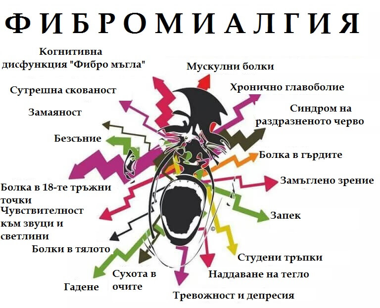 симптоми на фибромиалгията