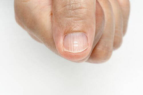 Как да премахнете линиите по ноктите на ръцете