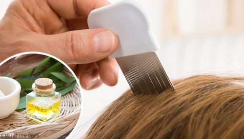 6 домашни средства за премахване на въшки