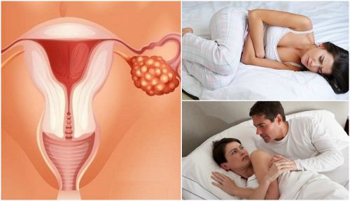7 симптома на рака на яйчниците, които трябва да познават всички жени