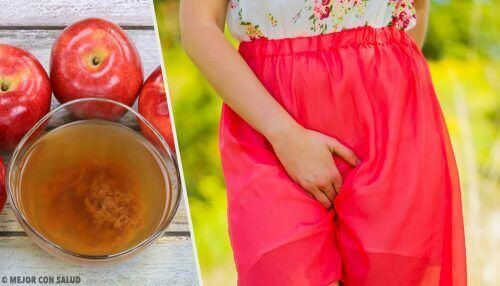 Натурални средства против вагинален сърбеж и парене