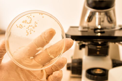 диагностициране на кандидозата