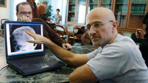 мечтата му като учен е да стане първият лекар направил успешна трансплантация на глава