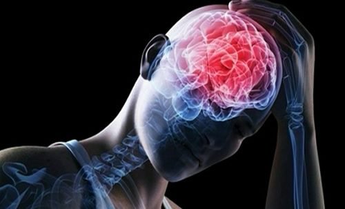 цереброваскуларни болести - емболия