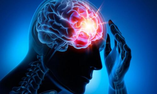 Четирите най-често срещани цереброваскуларни болести