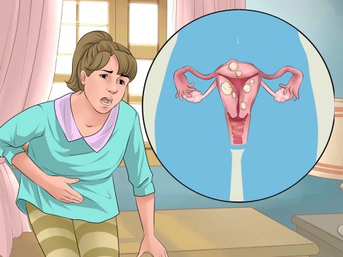 Натурални средства при менструални спазми и други подобни проблеми