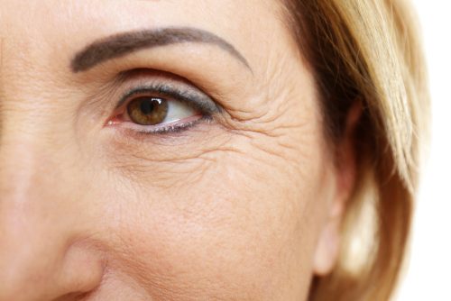 Значението на бръчките около очите и как да се предпазите от тях