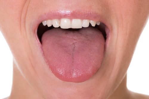 Първите 5 симптома на рак на езика