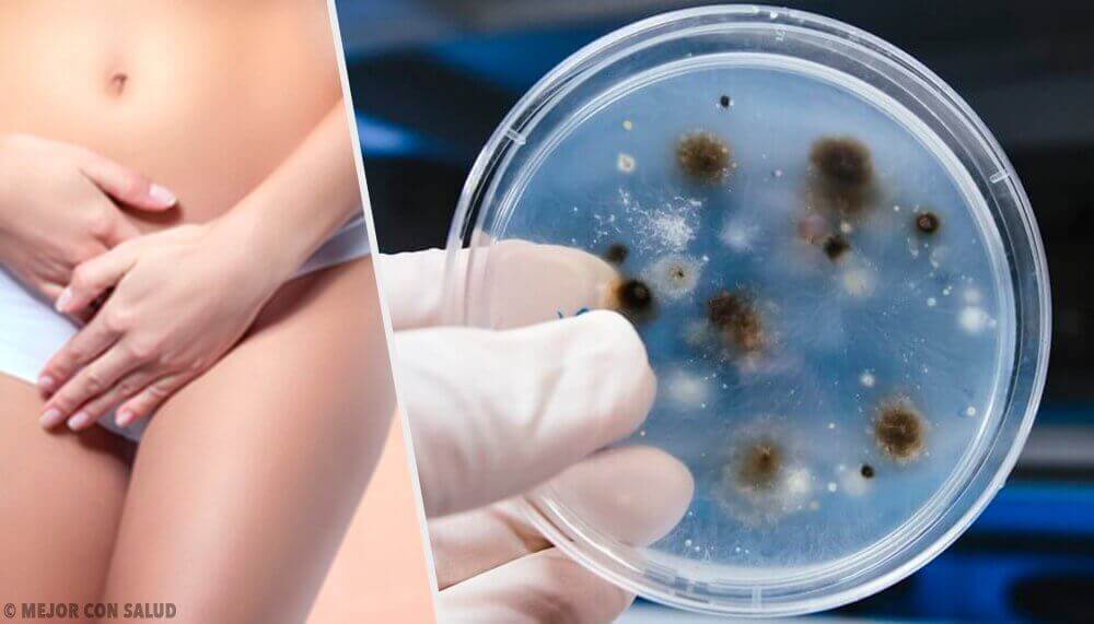 Вагиналните инфекции: Видове и причини за появата им