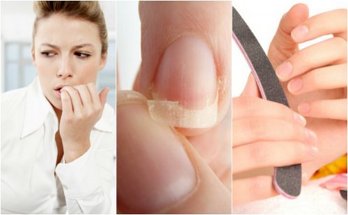 8 причини за чупливи нокти