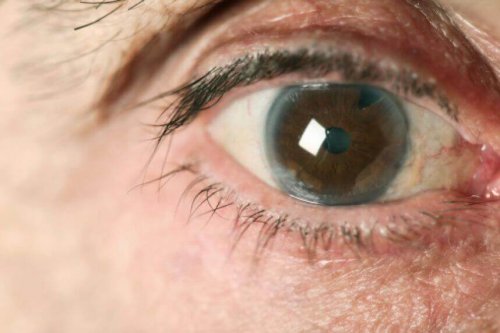 постовянето на навременна диагноза глаукома е изключително важно