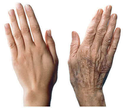 7 съвета с грижа против стареенето на кожата на ръцете