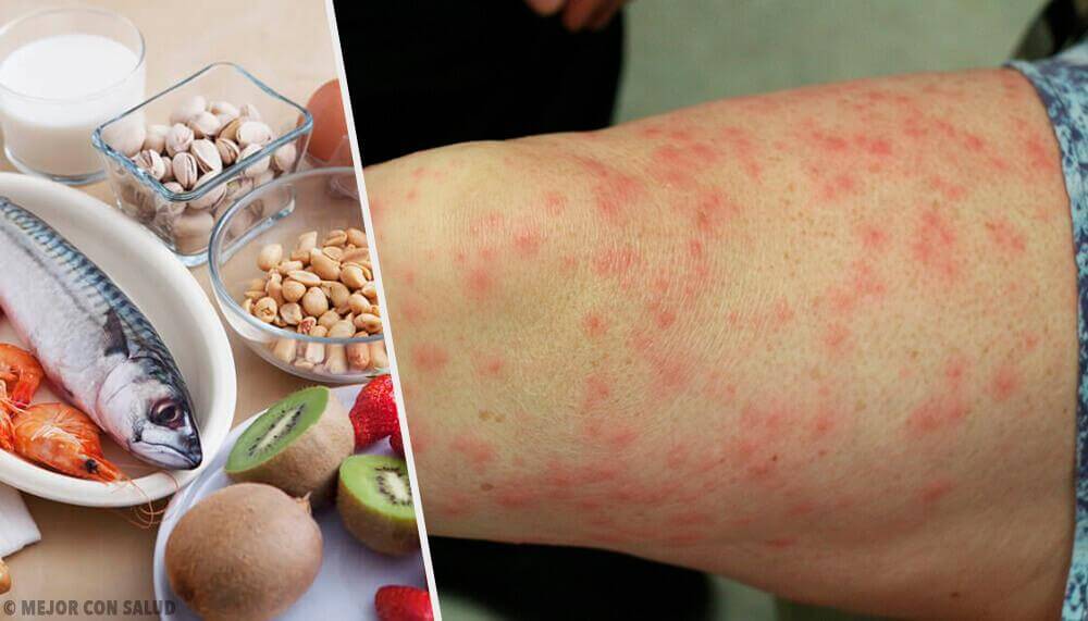 Хранителните алергени - кои са те и как да ги заменим