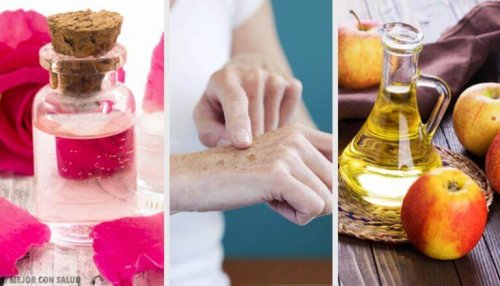 8 натурални продукта, с които да заличим пигментните петна по ръцете