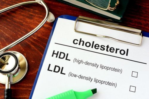 Холестеролът: добър и лош