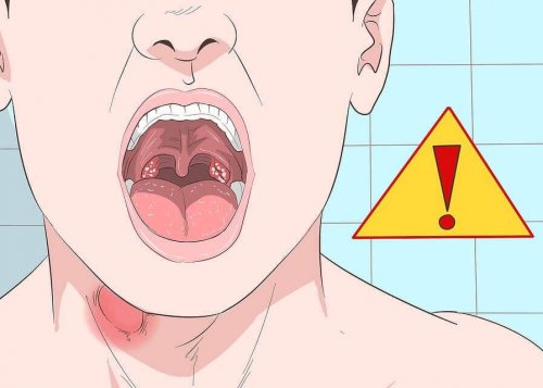 5 възможни симптомa за възли на гласните струни