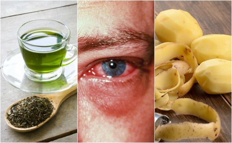 За лечение на възпалени очи: 8 ефективни домашни средства