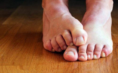 Ходилата са предразположени към появата на чести инфекции.