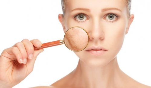 Хиперпигментацията по лицето може да е признак за здравословен проблем.