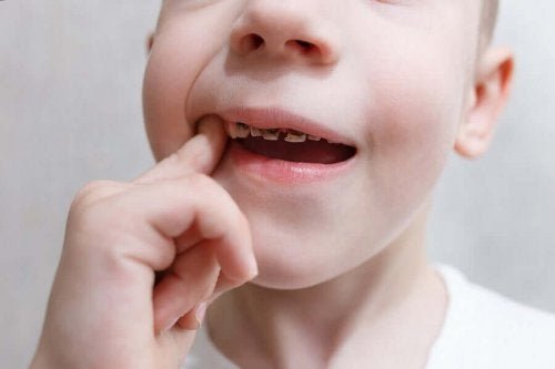 Захарта е сред основните причини за появата на зъбните кариеси.