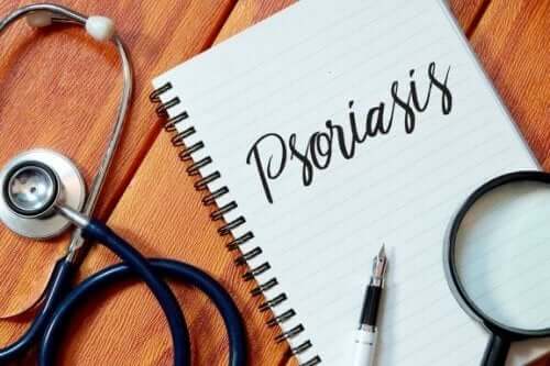 За предпазване от псориазис: 5 ефективни начина