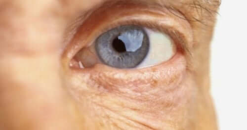 Макулната дегенерация: снимка на око на възрастен човек